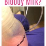 What Should I Do If I Pump Bloody Milk?