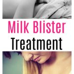 Milk Blister Treatment