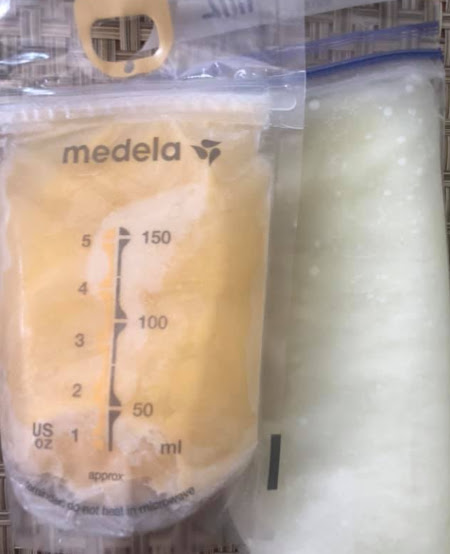 Orange Breastmilk: Orange breast milk in a Medela breastmilk freezer bag