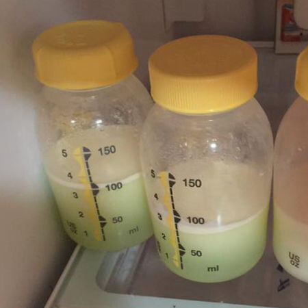 green breast milk