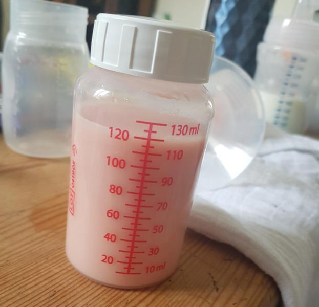 Why is my breast milk green, blue, or pink?