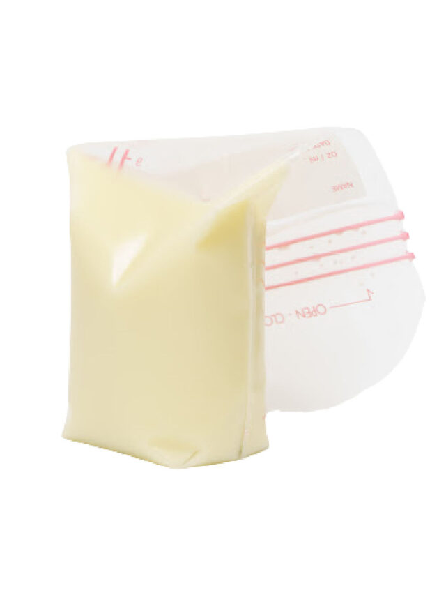 Excess Lipase in Breast Milk Exclusive Pumping