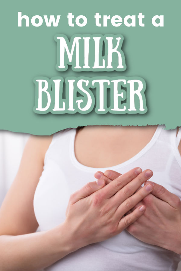 Blebs, spots, or milk blisters on the nipple