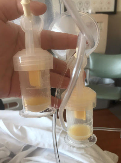 Woman in hospital holding up bottles of pumped colostrum